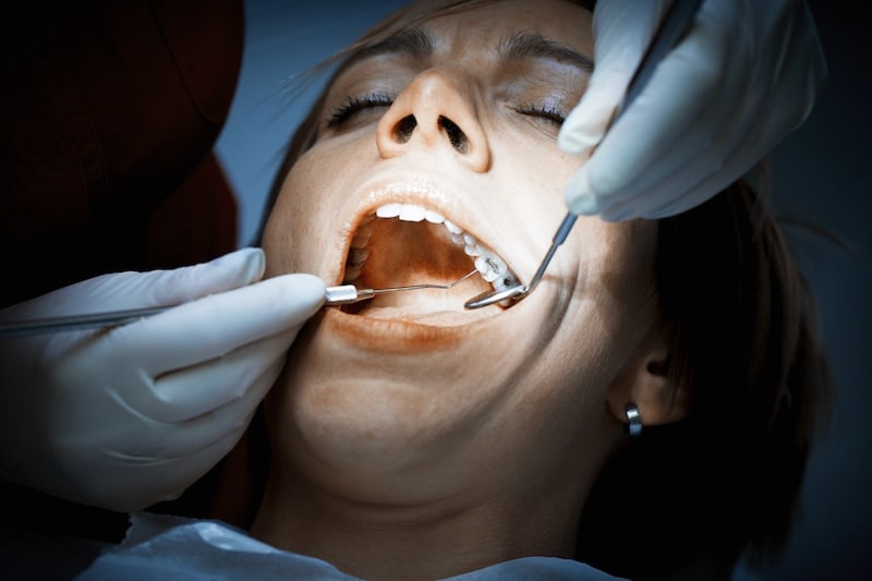 Dentist examining a patients teeth before oral surgery at the dental clinic. Removing amalgam fillings. Professional care of patient teeth.